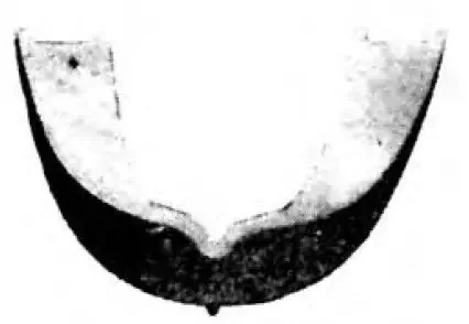 Gardent – Teeth Guard Plastic White – 1081213