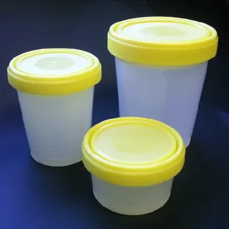 Globe Scientific – Lab Storage Container Pathology Container Polypropylene 1,000 mL (32 oz.) – 6545