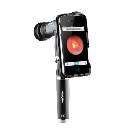 iExaminer – Ophthalmoscope Adapter Adapter for iPhone 6 and 6s For PanOptic Ophthalmoscope iPhone 6 and 6S – 11840-A6