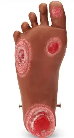 Life/form GERi and KERi Optional Pressure Injury Foot – Foot Wound Care Model 2-1/2 lbs. – LF04128