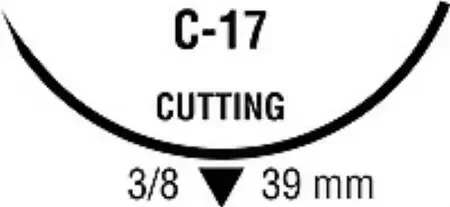 Monosof~Dermalon – Suture with Needle Nonabsorbable Uncoated Black Suture Monofilament Nylon Size 4 – 0 30 Inch Suture 1-Needle 39 mm Length 3/8 Circle Reverse Cutting Needle – SN-672