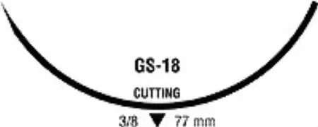 Monosof~Dermalon – Suture with Needle Nonabsorbable Uncoated Black Suture Monofilament Nylon Size 2 30 Inch Suture 1-Needle 77 mm Length 3/8 Circle Reverse Cutting Needle – CN-490