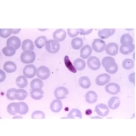 Naegleria Fowleri – Parasitology Stained Slide 1 X 3 Inch Plain – 8970