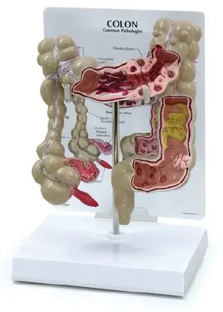 Nasco – Colon Model – SB35434