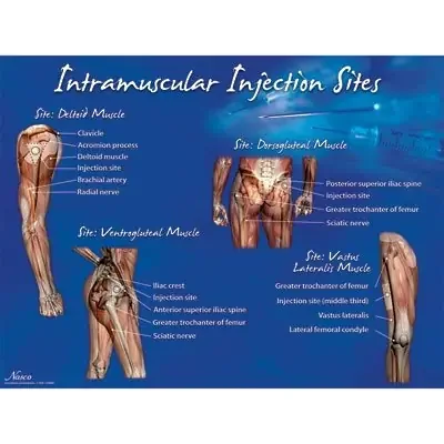 Nasco Healthcare – Educational Poster Intramuscular Injection Sites Training Poster 18 X 24 Inch Heavy Paper Grommets Laminated – LF00695