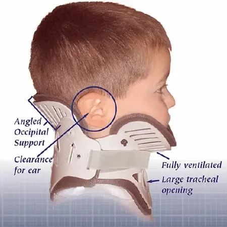 NecLoc – Rigid Cervical Collar Preformed Pediatric (2 to 6 Years) Size P2 Two-Piece / Trachea Opening – NL-P2