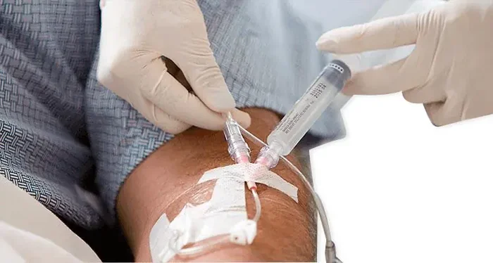 Nexiva Diffusics – Closed IV Catheter 20 Gauge 1.25 Inch Without Safety – 383593