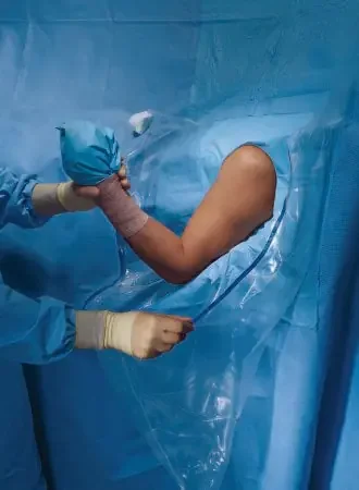O&M Halyard – Orthopedic Drape Shoulder Arthroscopy Drape 160 W X 102 L Inch Sterile – 89070