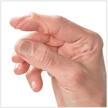 Oval-8 – Finger Splint Adult Size 6 Pull-On Right Hand Beige – P1008-5-06