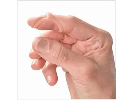 Oval-8 – Finger Splint Adult Size 9 Pull-On Left or Right Hand Beige – P1008-5-09