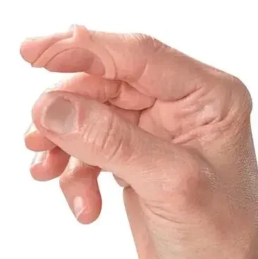 Oval-8 – Finger Splint Kit Adult Size 2 to 15 Pull-On Left or Right Hand Tan – P1008-K