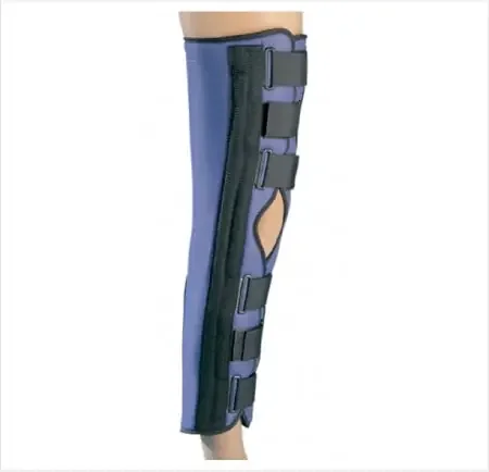 ProCare – Knee Splint 2X-Large Loop Lock Closure 26 to 30 Inch Circumference Left or Right Knee – 79-80059