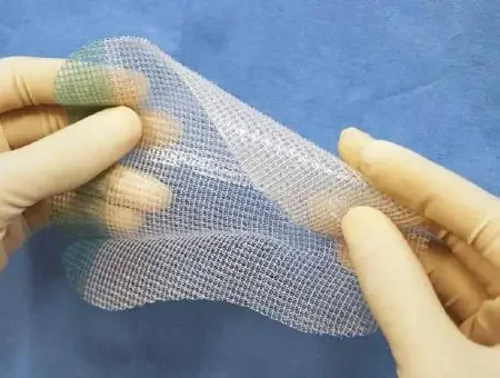 ProGrip – Self-Fixating Hernia Repair Mesh Partially Absorbable Knitted Polyester Monofilament / Polylactic Acid (PLA) 10 X 15 cm Rectangle Style – LPG1510
