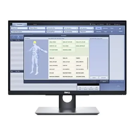 Rayence – Imaging Monitor Touch Screen For use with X-Ray System – V0800013